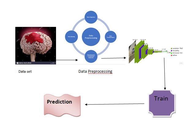 Brain-haemorrhage-detection-using-cnn